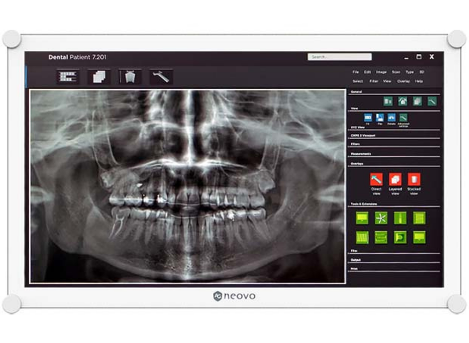 AG Neovo DR-2202 22" 5ms Full HD Dental LCD Monitor Ag Neovo Healthcare Monitors AG Neovo